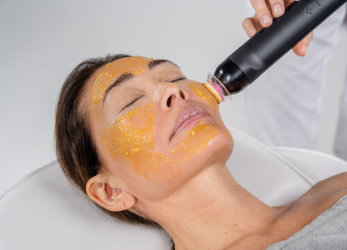 Spring Clean Your Skin: 15% Off a Series of 3 Facials or Chemical Peels!